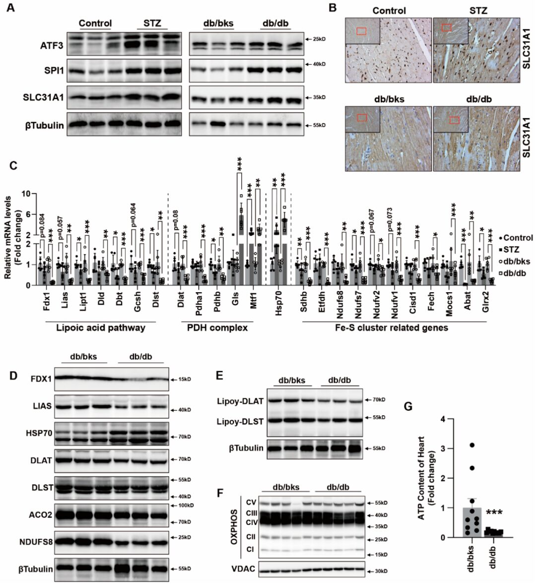 ATF3/SPI1/SLC31A1 Pathway Promotes Copper Death Induced by AGEs in Diabetic Myocardial Injury