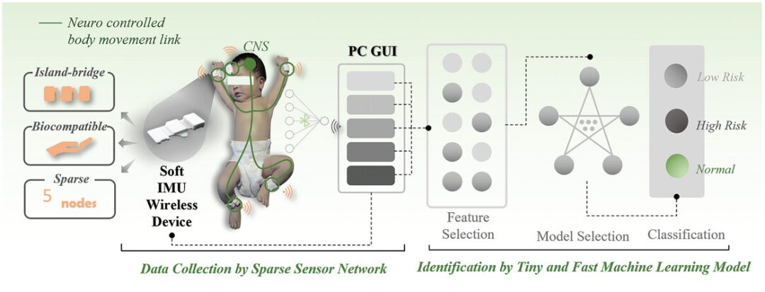 Flexible Intelligent Sparse Sensor Network for Infant Movement Assessment