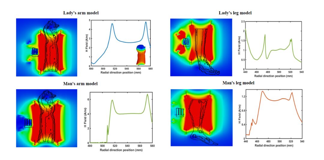 High-Q Metasurface Signal Isolator for Portable MRI Devices