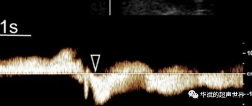 Guidelines for Ultrasound Evaluation of Varicoceles