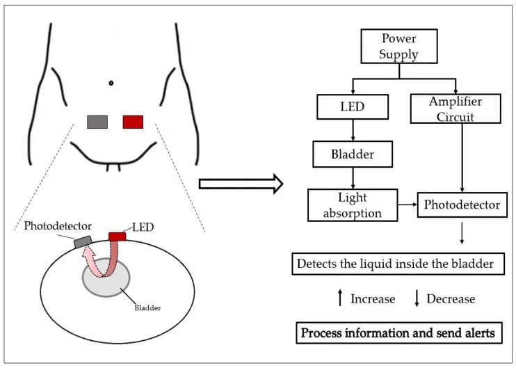 Recent Advances in Non-Invasive Bladder Monitoring Technologies