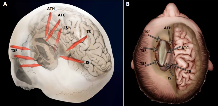 The Anatomical Significance of Brain White Matter Tracts