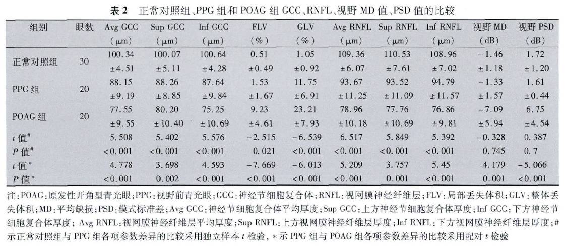 Preliminary Study on GCC Thickness Detection in PPG Patients Using SD-OCT