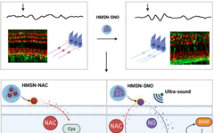 Ultrasound-Triggered NO Release for Hearing Loss Therapy