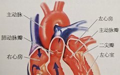Understanding Pulmonary Valve Regurgitation