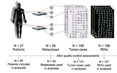 Exploring GeoMx DSP Applications in Cancer Research