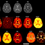 DXI: A Powerful Tool for Clinical Research in Advanced Diffusion Models
