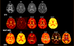 DXI: A Powerful Tool for Clinical Research in Advanced Diffusion Models