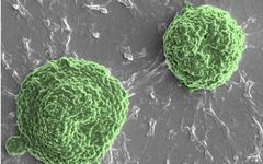 Algae-Based Antitumor Microbots