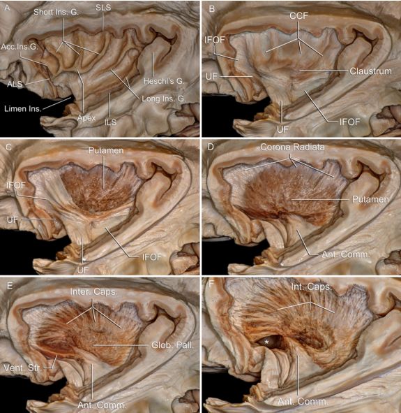 The Anatomical Significance of Brain White Matter Tracts