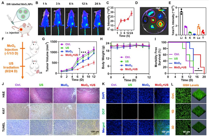 Oxygen-Deficient Molybdenum Oxide Nanosensitizers for Ultrasound-Enhanced Cancer Metalloimmunotherapy