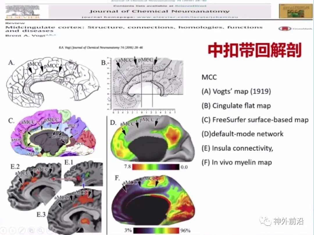 Cingulate Cortex Epilepsy and Surgical Treatment