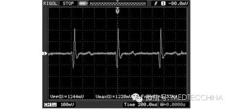 How to Solve the Miniaturization of ECG Monitors