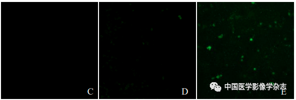 Inhibition of Breast Cancer Cells by Novel Nanoparticles Combined with Low-Intensity Focused Ultrasound