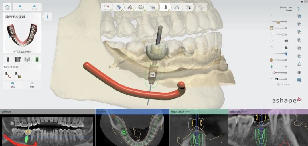 How 3D Printing Technology Benefits Oral Health