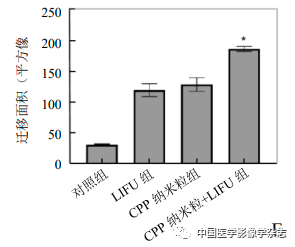 Inhibition of Breast Cancer Cells by Novel Nanoparticles Combined with Low-Intensity Focused Ultrasound