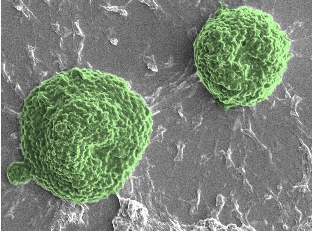 Algae-Based Antitumor Microbots