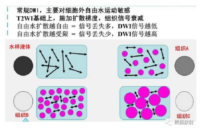Principles and Clinical Applications of Diffusion Weighted Imaging (DWI and ADC)