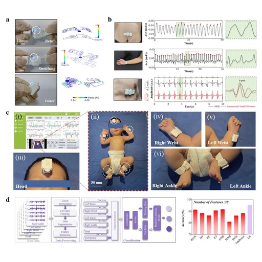 Sparse Sensor Networks for Rapid Screening of Infant Cerebral Palsy