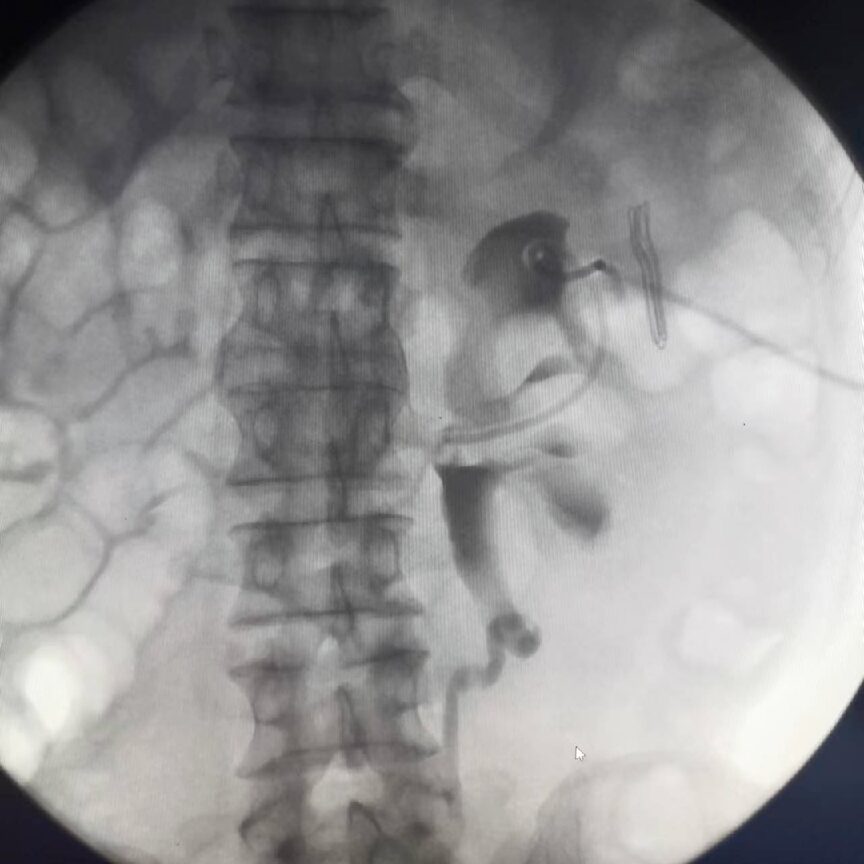 Clinical Use of Digital Gastrointestinal Imaging Equipment