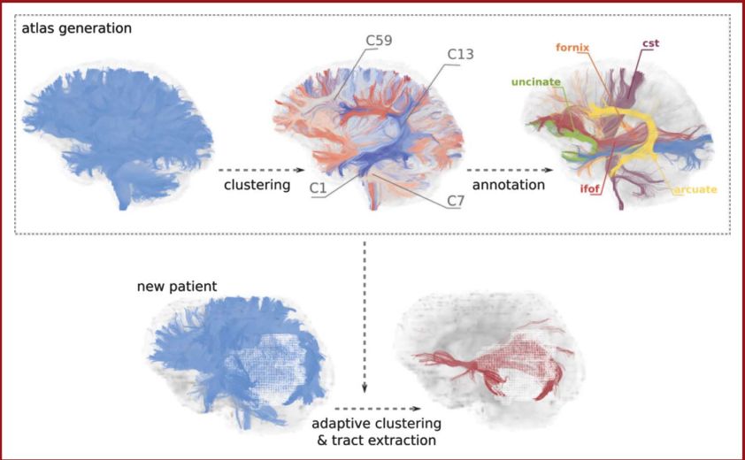 The Anatomical Significance of Brain White Matter Tracts