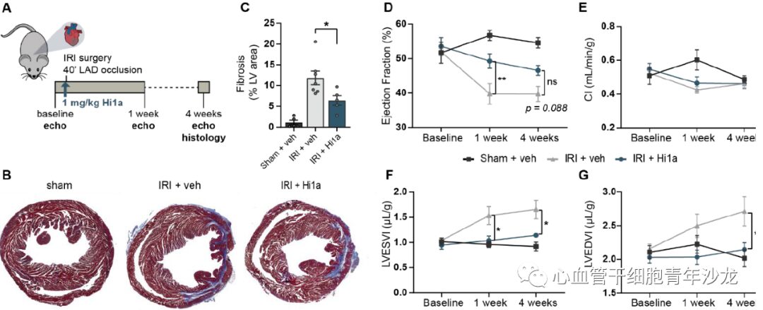 Therapeutic Inhibition of Acid Sensing Ion Channel 1a Recovers Heart Function After Ischemia-Reperfusion Injury