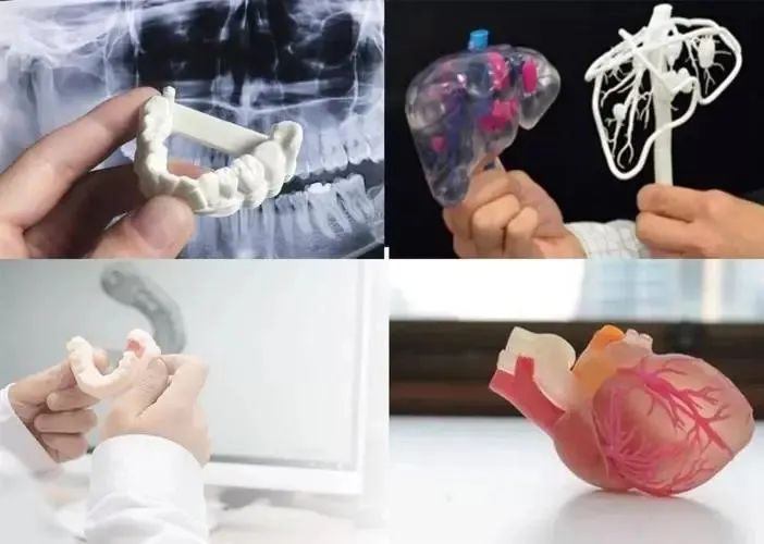 How 3D Printing Technology Benefits Oral Health