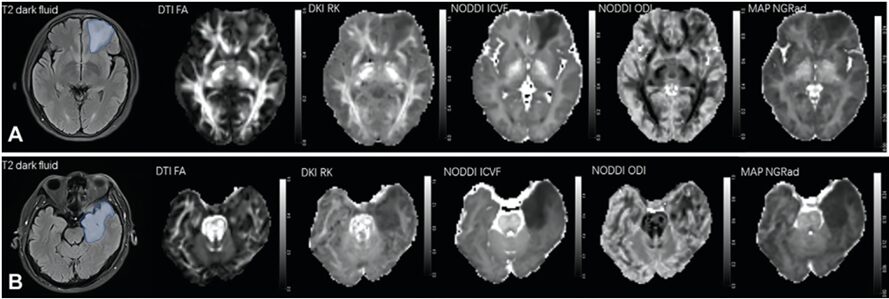 DXI: A Powerful Tool for Clinical Research in Advanced Diffusion Models
