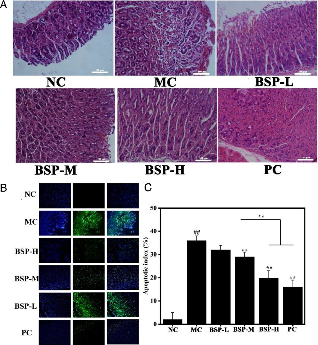Extraction, Purification, and Gastroprotective Activity of Glucomannan from Bletilla Striata
