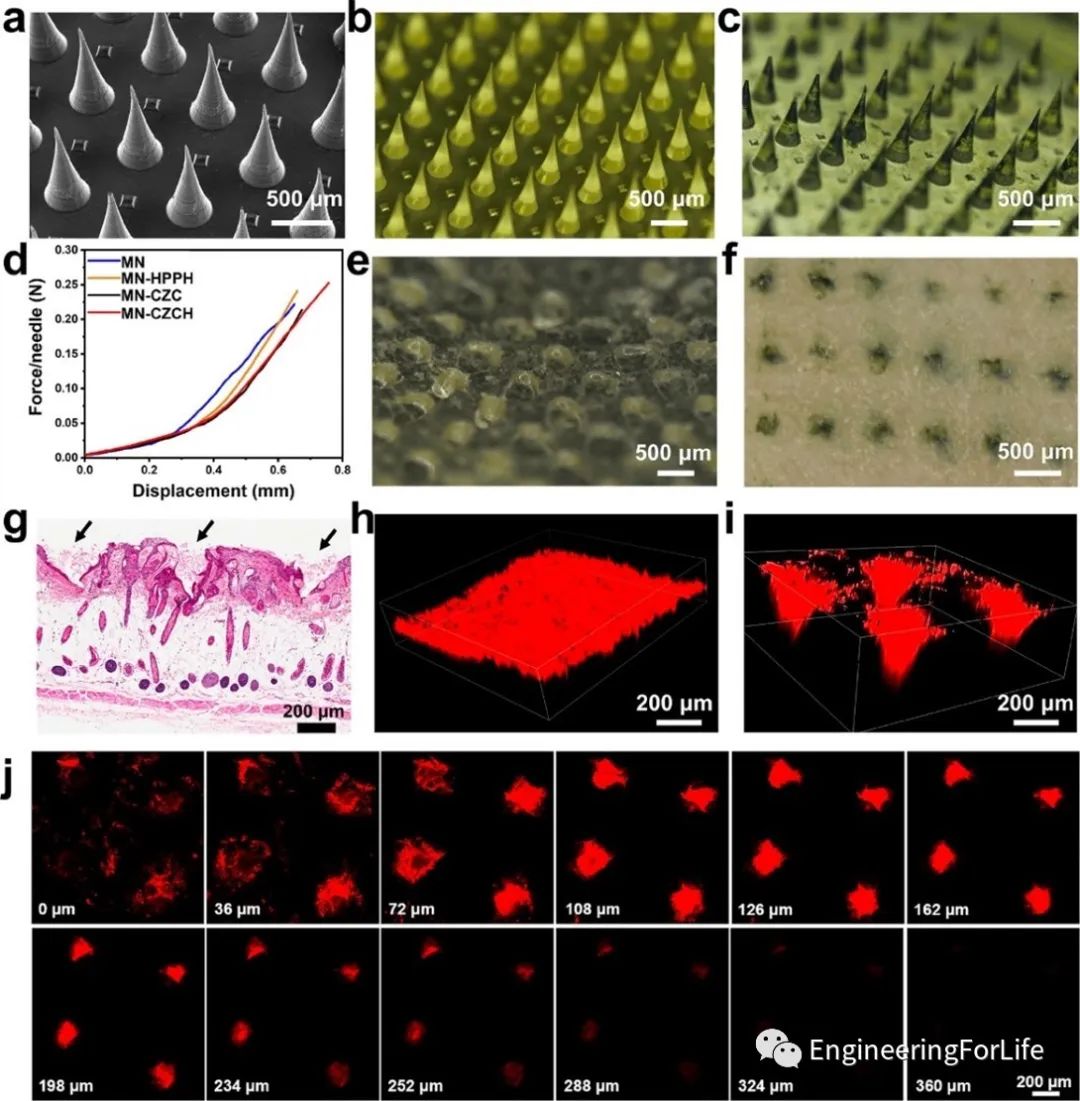 Self-Oxygenating & Glutathione-Depleting Microneedle Patch for Photodynamic Therapy of Tumors