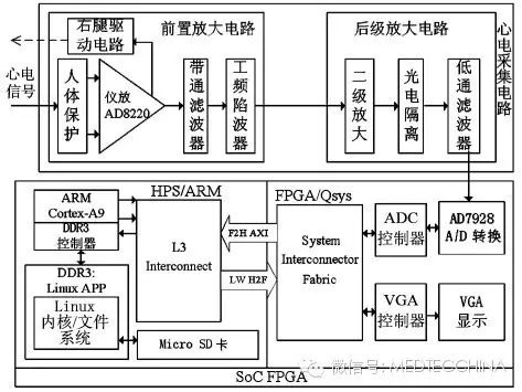 How to Solve the Miniaturization of ECG Monitors