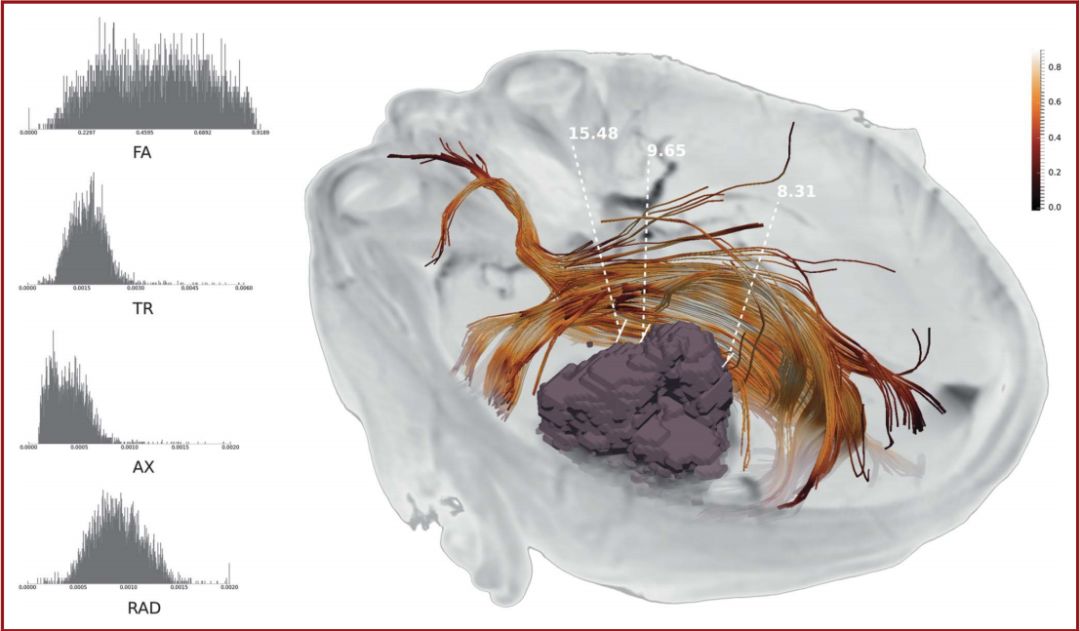 The Anatomical Significance of Brain White Matter Tracts