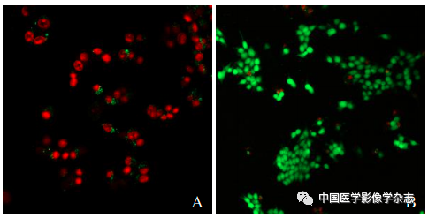 Inhibition of Breast Cancer Cells by Novel Nanoparticles Combined with Low-Intensity Focused Ultrasound