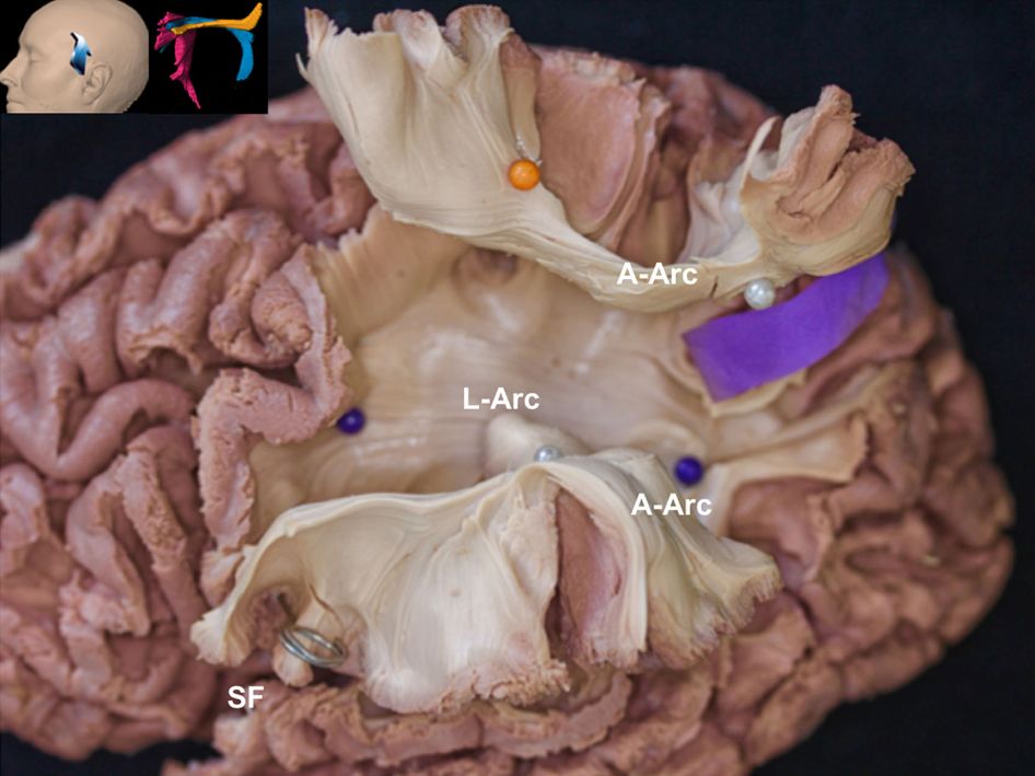 The Anatomical Significance of Brain White Matter Tracts