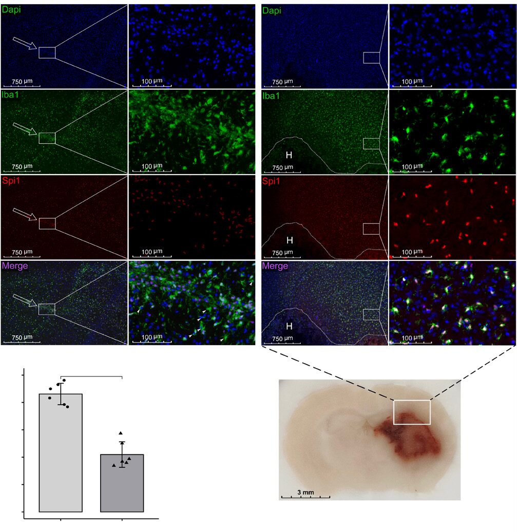 Spi1 Regulates Inflammatory Response of Microglia/Macrophages After Intracerebral Hemorrhage via PI3K/AKT/mTOR Pathway
