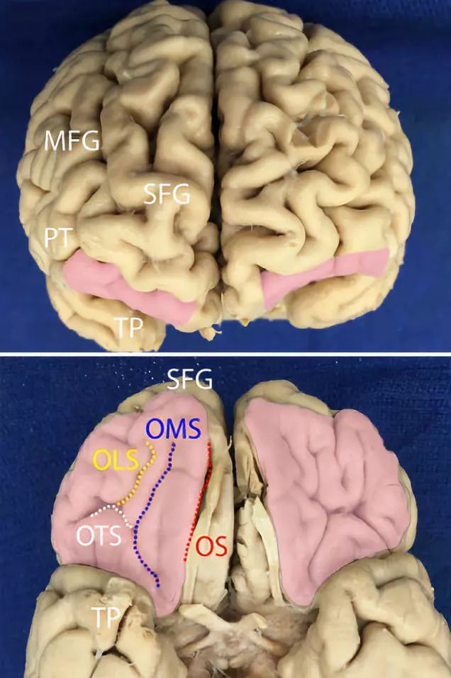 The Anatomical Significance of Brain White Matter Tracts