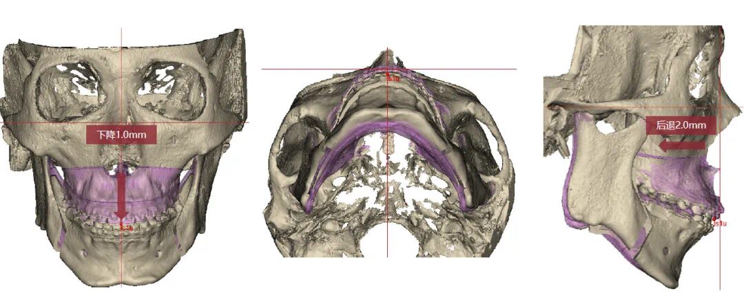 How 3D Printing Technology Benefits Oral Health