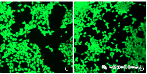 Inhibition of Breast Cancer Cells by Novel Nanoparticles Combined with Low-Intensity Focused Ultrasound