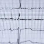 Physiological Signal Recognition of Emotional Activities with MATLAB