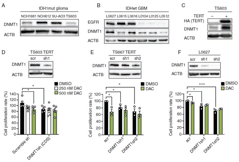 TERT and DNMT1 Expression Predicts Glioma Sensitivity to DAC