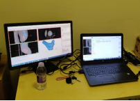 Innovative Uses of 3D Printing in Trauma Orthopedic Surgery