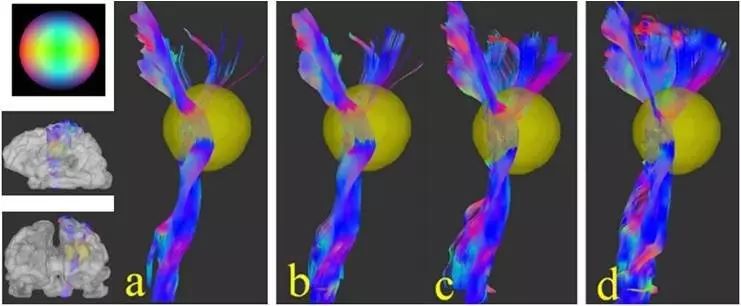 Understanding Q-Space Imaging in Diffusion MRI