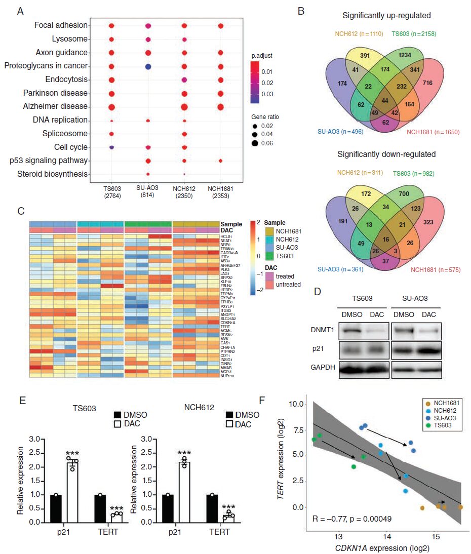 TERT and DNMT1 Expression Predicts Glioma Sensitivity to DAC