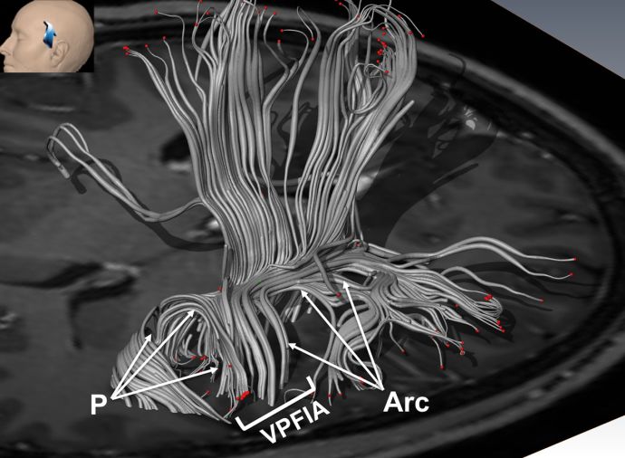 The Anatomical Significance of Brain White Matter Tracts