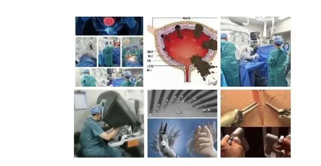 Da Vinci Surgical Robot System