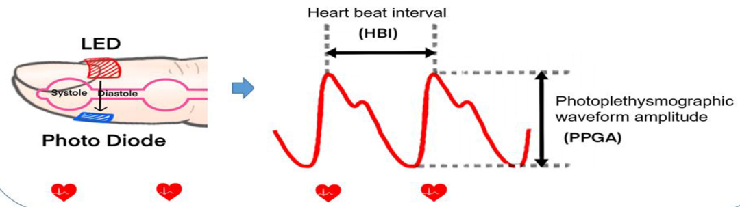 Application of Surgical Pleth Index (SPI) in Pain Monitoring