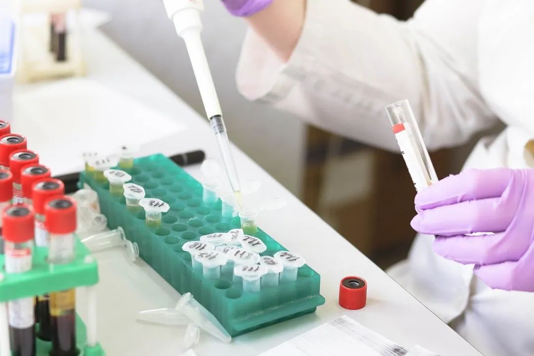 Key Points of DNA Methylation (BSP MSP) Technology