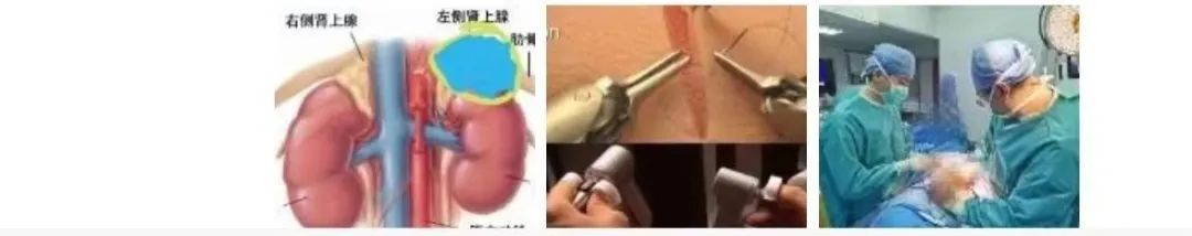 Da Vinci Surgical Robot System