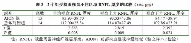 Assessment of GCC and RNFL Thickness in AION Diagnosis