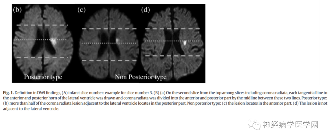 Types of Infarction in Perforating Artery Disease and Advances in Neuroimaging Research
